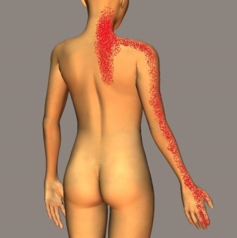 大和市中央林間で手の痛みやしびれで悩んでいる人へ