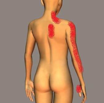 大和市中央林間で手の痛みしびれを改善