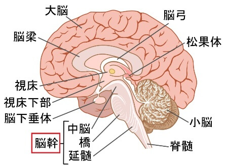 頭痛と脳幹